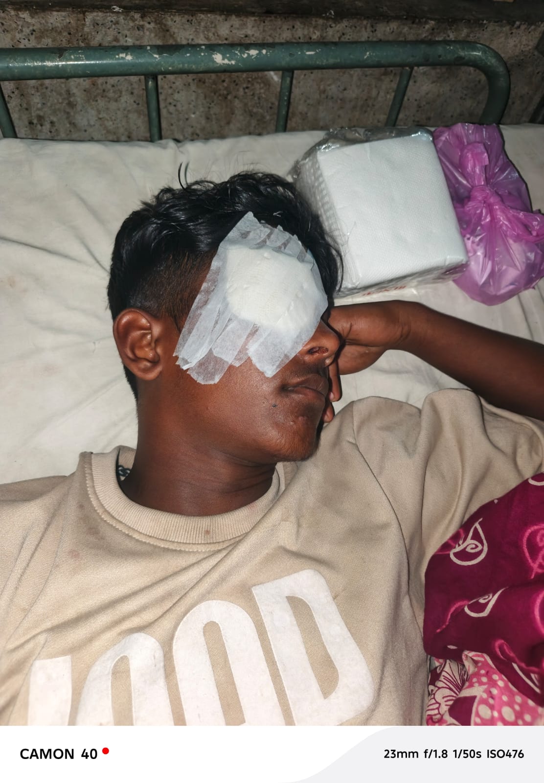 স্বেচ্ছাসেবকদল নেতার সন্ত্রাসী হামলায় চোখ হারানোর শঙ্কায় শেরপুরের পিকআপ চালক