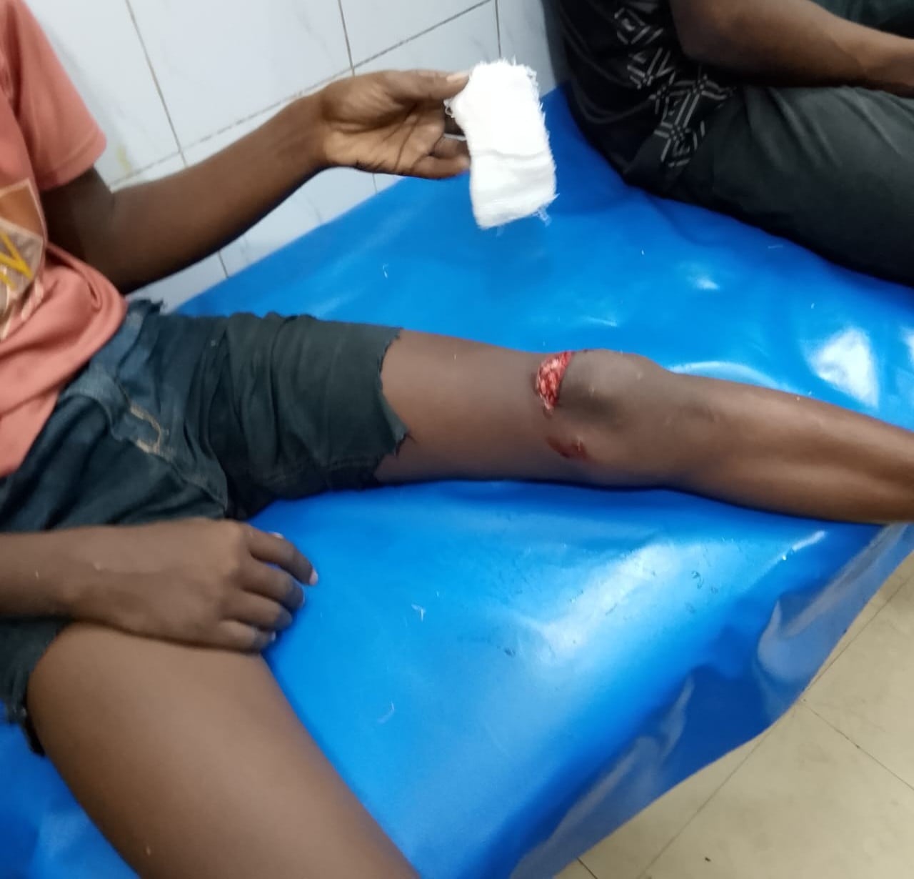 শ্রীমঙ্গলে শিয়ালের কামড়ে ১৬ জন আহত