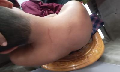 নির্বাচন পরবর্তী সহিংসতা কাঁঠালিয়ায় জনসভা থেকে বাড়ী ফেরার পথে হামলা