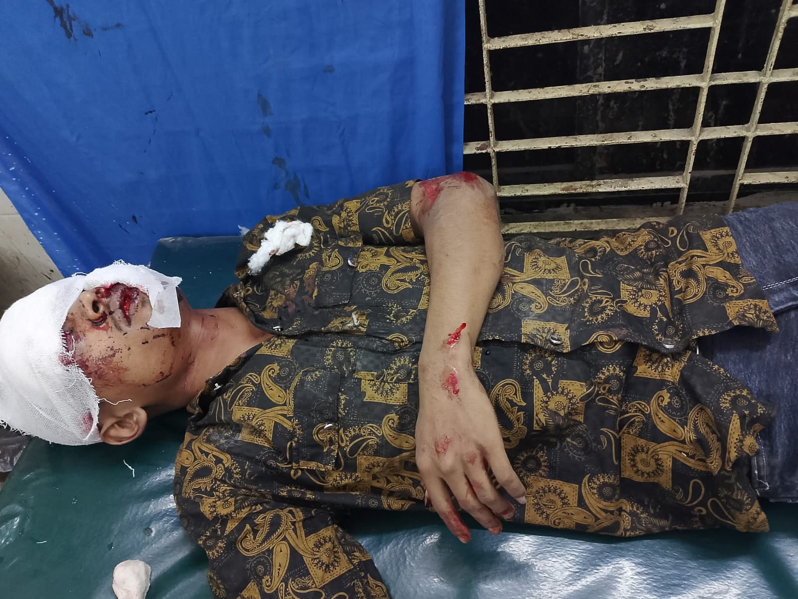 মান্দায় সড়ক দুর্ঘটনায় দুই বন্ধু নিহত, আহত ৪