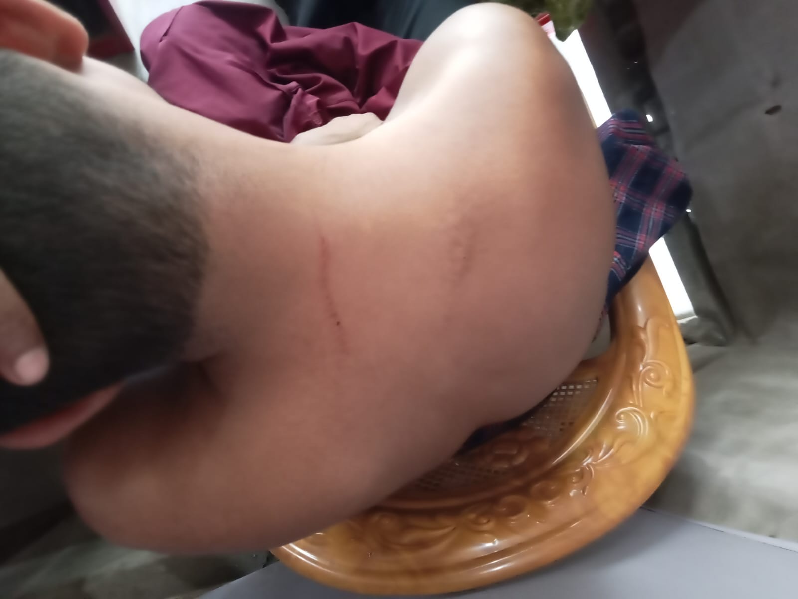 নির্বাচন পরবর্তী সহিংসতা কাঁঠালিয়ায় জনসভা থেকে বাড়ী ফেরার পথে হামলা