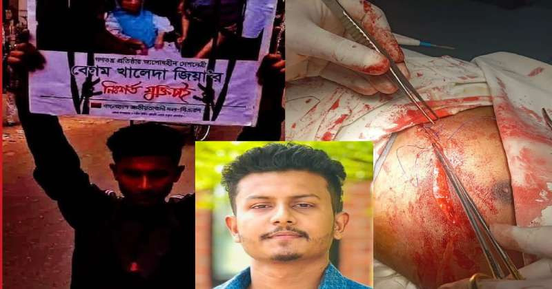 উত্তরায় ছাত্রদল নেতার ওপর দুর্বৃত্তদের হামলা